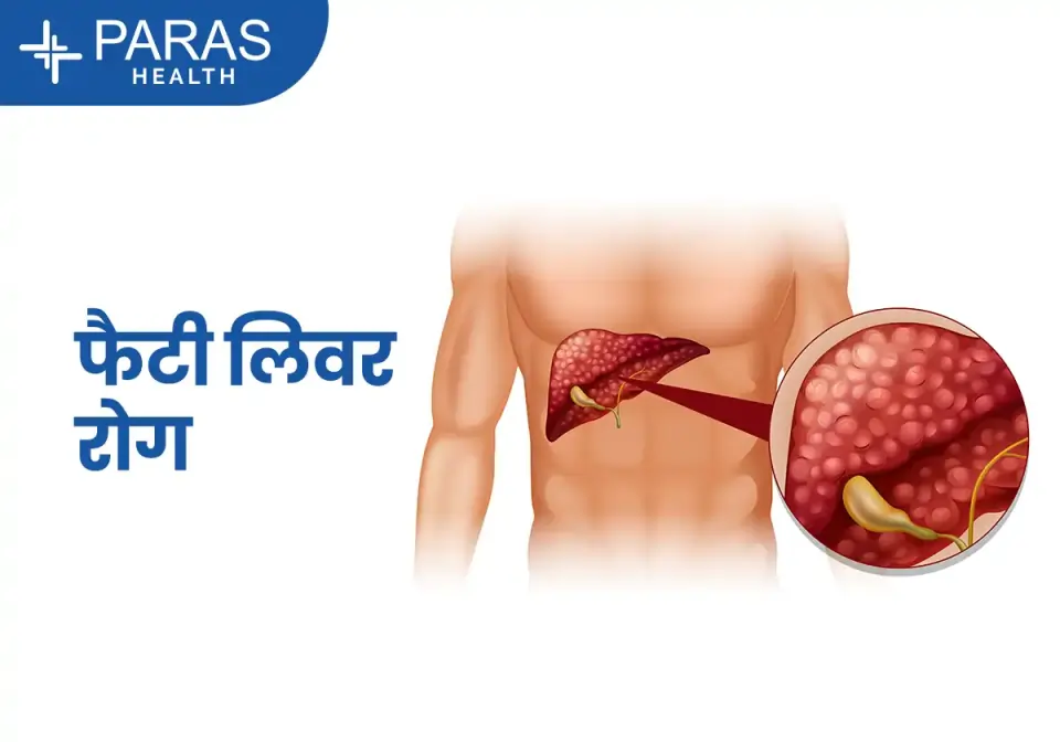 फैटी लिवर डिज़ीज़